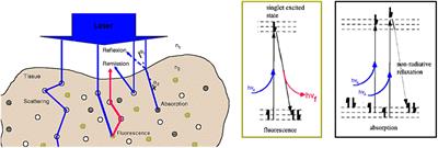 5-ALA induced PpIX fluorescence spectroscopy in neurosurgery: a review